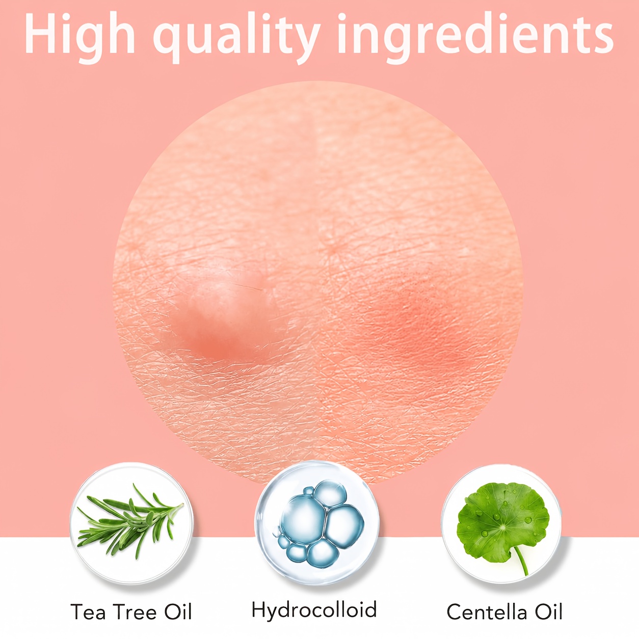 1200/400pcs/box invisible acne - Skincare Gentle review and price