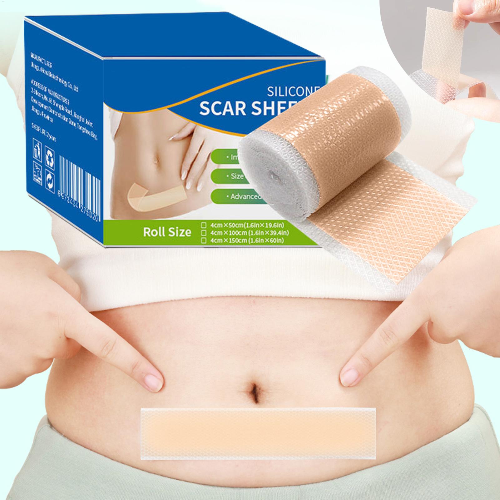 1 Roll Silicone Scar Sheets 4c - Skincare Collagen review and price